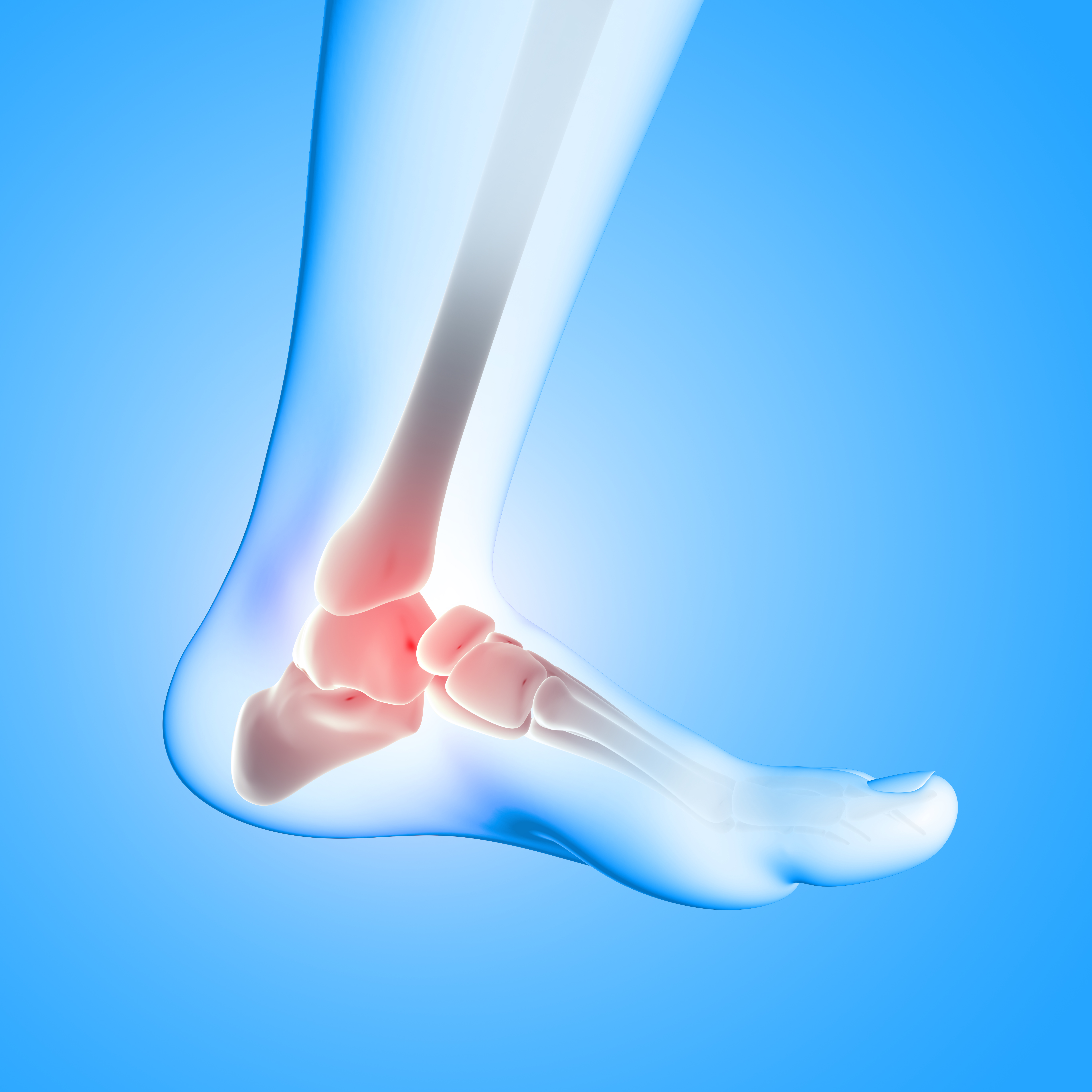 Ankle Pain