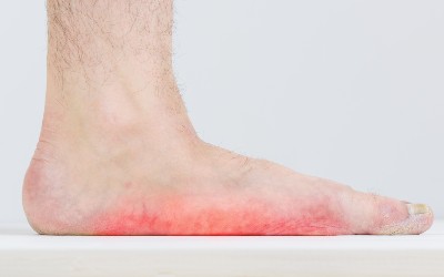 Facts About Flat feet