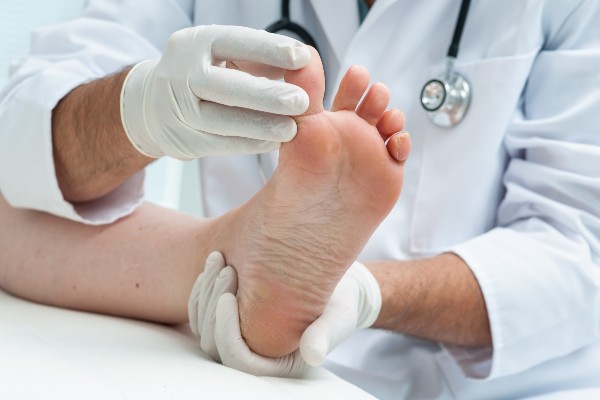 Treating Toe Deformities